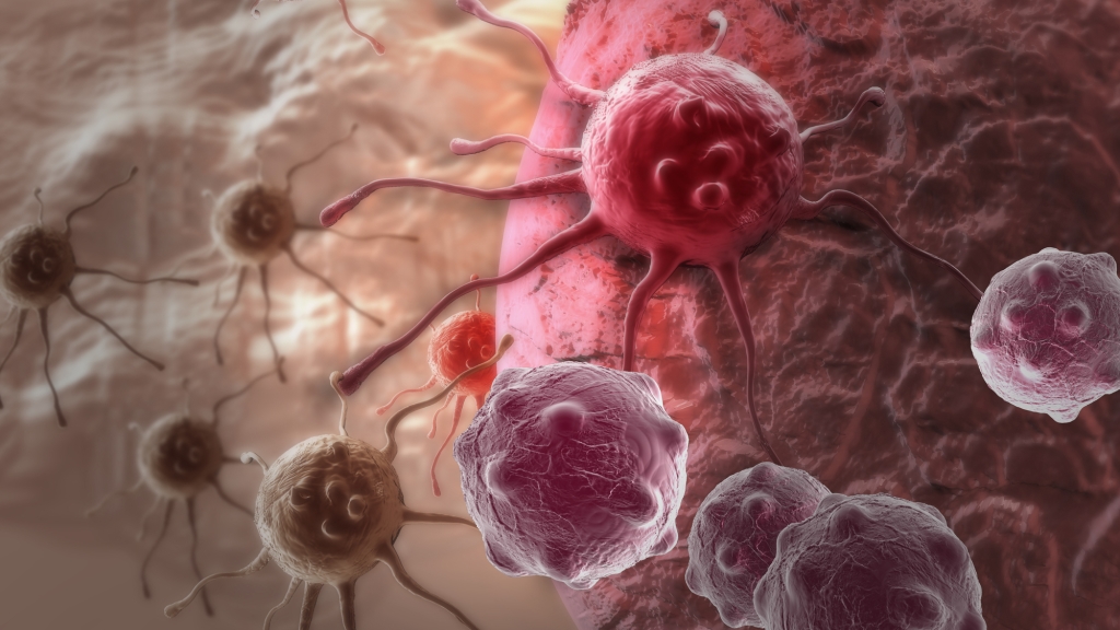 Израильские ученые обнаружили, что протеин S препятствует метастазированию рака